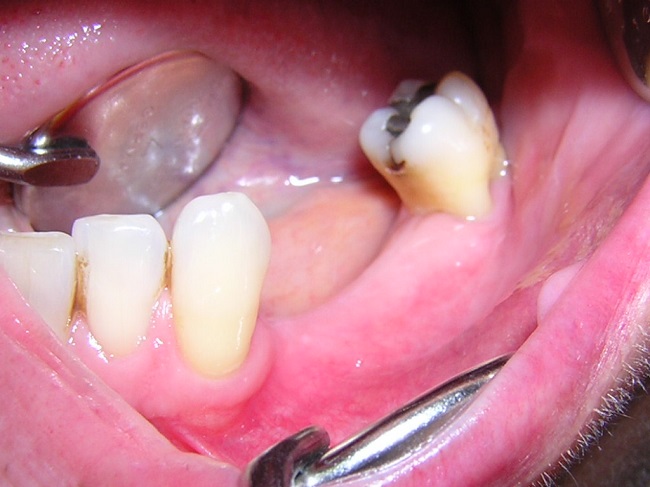 dental 010